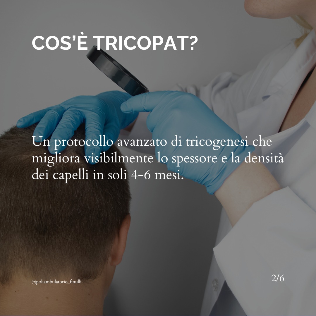 Tricop2